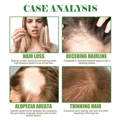 Style Loft Collection Essential Rosemary Hair Repair Oil